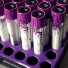 blood counting test|Blood Count Tests: MedlinePlus.